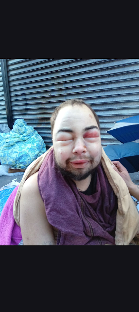 A man with a severely swollen face.